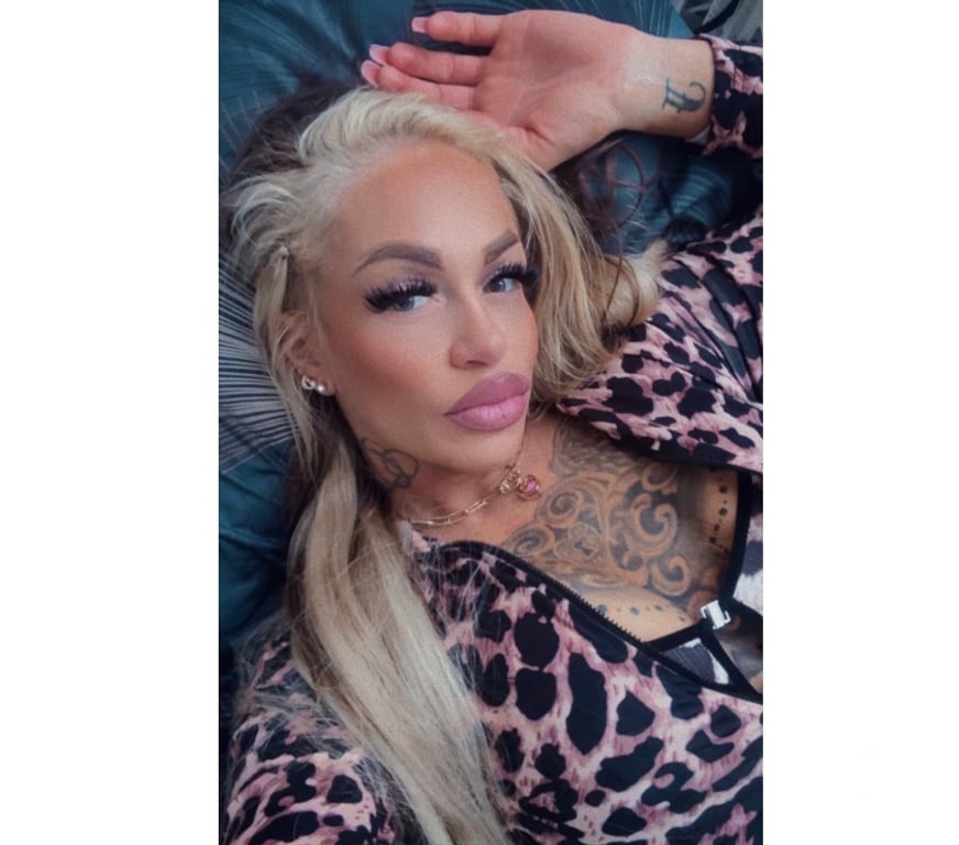 Escorts East London Hackney - East London - Photos for 🔥🍒🍒Cerry🍒🍒🔥