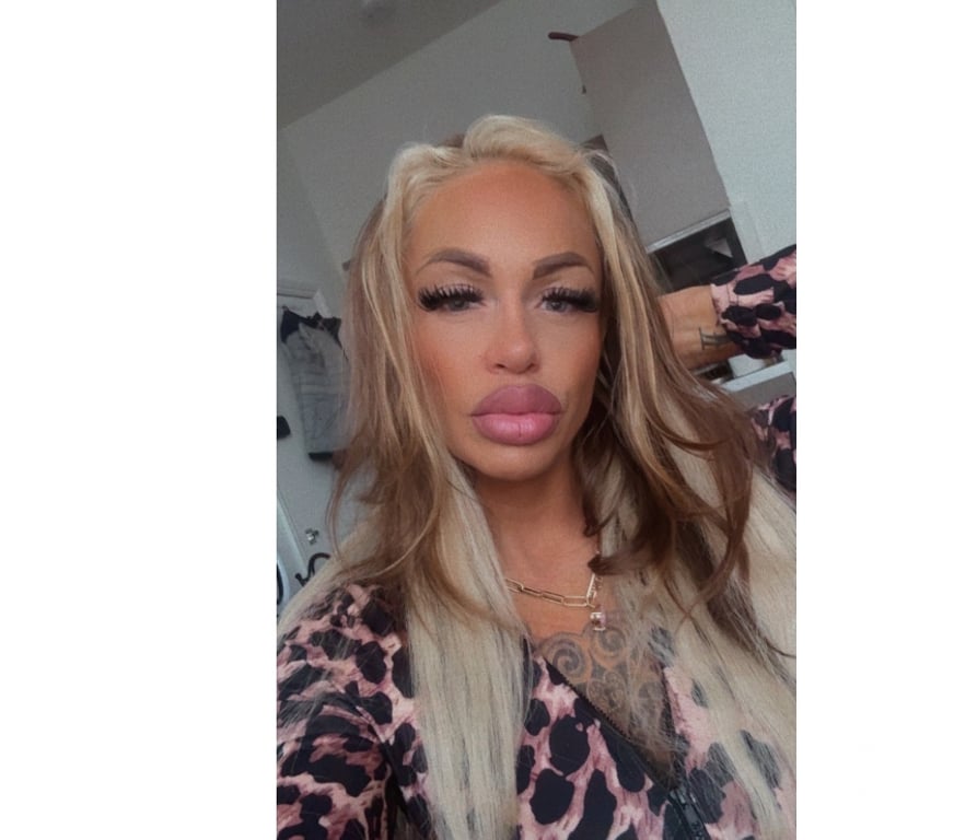 Escorts East London Hackney - East London - Photos for 🔥🍒🍒Cerry🍒🍒🔥