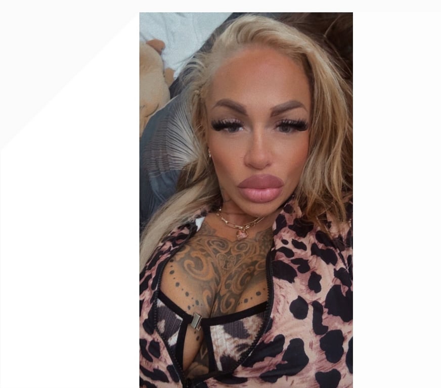 Escorts East London Hackney - East London - Photos for 🔥🍒🍒Cerry🍒🍒🔥