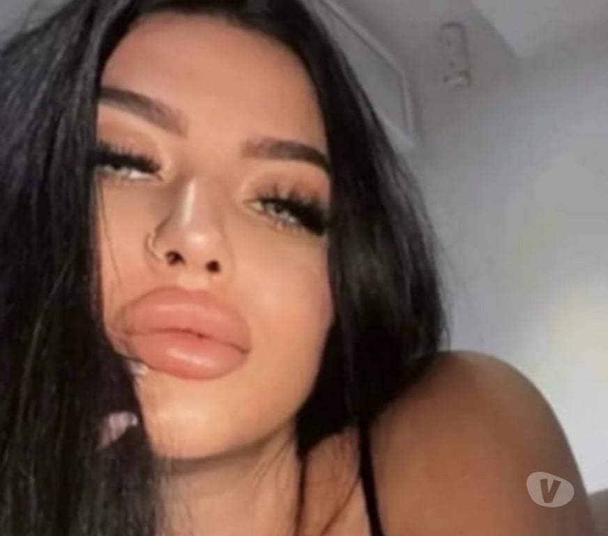 Escorts Gloucestershire Cheltenham - Photos for 🍭🦋Bella New Only Few Days🦋Best Service🦋🍭