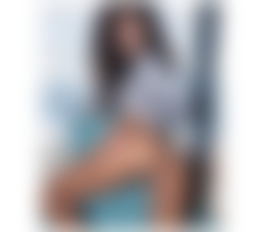 Escorts Dunfermline Fife - Photos for 💫🍎CHARLOTTE🍎💫maximum passion