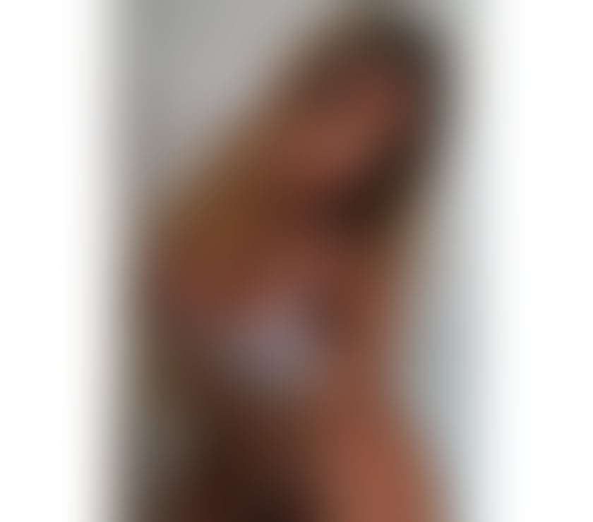 Escorts Cannock Cannock Chase - Photos for Olivia HOT Girl💥100% GENUINE Best service in your Town