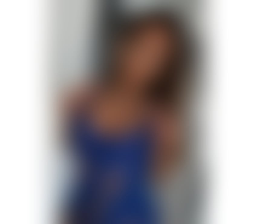 Escorts Staffordshire Cannock Chase - Photos for Olivia HOT Girl💥100% GENUINE Best service in your Town