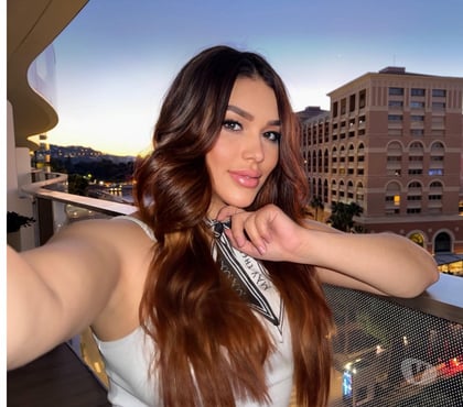 Escorts Stoke on Trent City Centre Stoke-on-Trent - Photos for 🇧🇷GIRL FOR YOU🥵REAL GFE ❤️STOKE