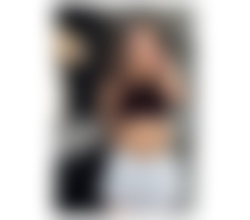  Escorts Hendon Central Station North West London - Photos for Dwarf 🔥HOT GIRL NO RUSH💋PARTY AND GFE💞