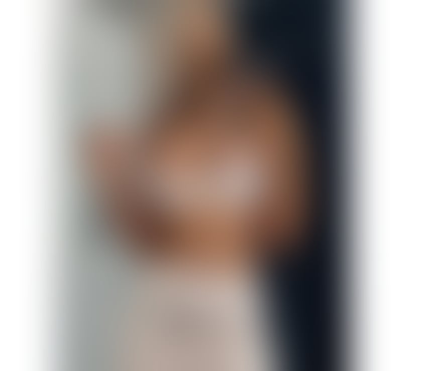 Escorts Hertfordshire Dacorum - Photos for 💎🍑🆕 MIA DIAMOND 🆕 NEW IN TOWN 🍑💎