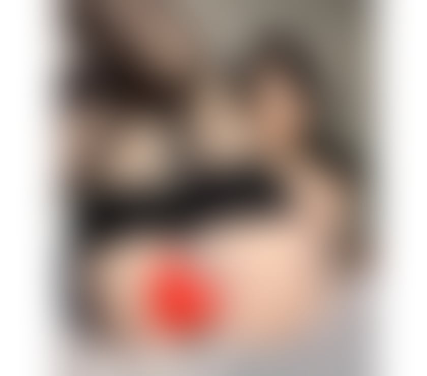 Escorts Edinburgh Greenbank - Edinburgh - Photos for 🔥Super Sexy Girl🔥First-class🥂 Service100%