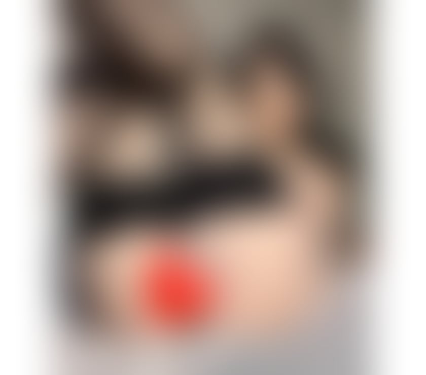  Escorts Greenbank Edinburgh - Photos for 🔥Super Sexy Girl🔥First-class🥂 Service100%