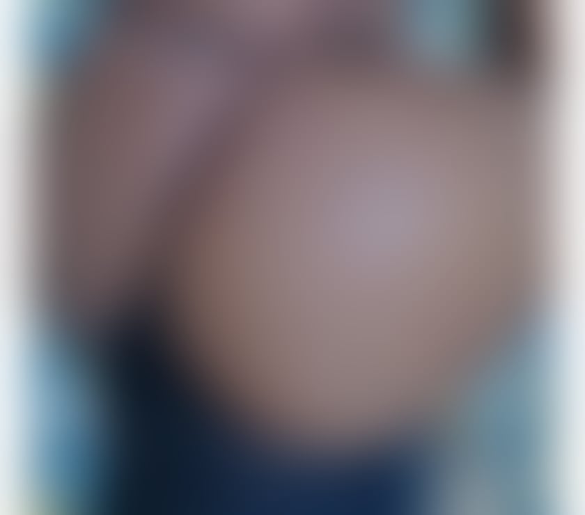 Escorts Kent Medway - Kent - Photos for 💕EBONY NICKI ONLY HERE FOR TODAY BOOK NOW 💕