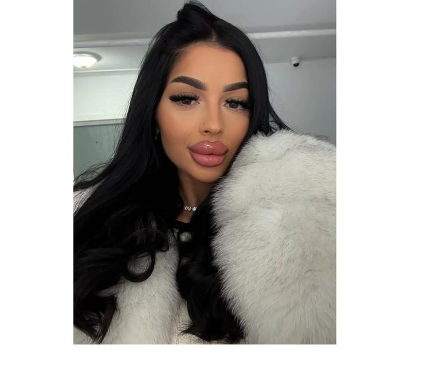 Escorts Denbighshire - Wales Rhyl - Denbighshire - Photos for ❤️‍🔥NEW IN TOWN❤️‍🔥REAL PIC💯NO RUSH ❌