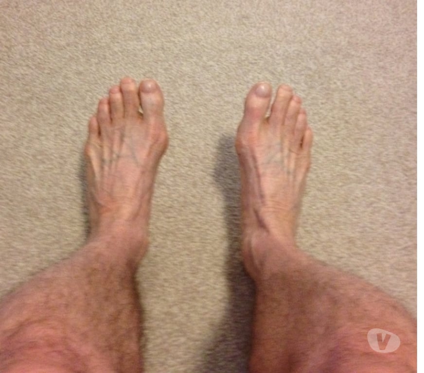 Escorts East Sussex Brighton - Photos for Naked Tantric Massage