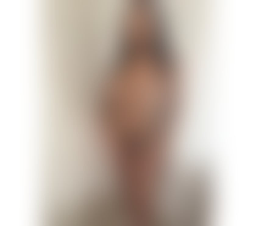 Escorts Essex Colchester - Photos for 🇧🇷BRUNA BRAZILIAN GIRL🇧🇷-REAL PICT GUARANTEED