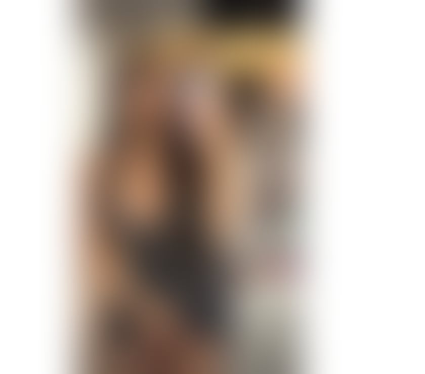 Escorts Lancashire Burnley - Photos for 💕A Beauty Girl-Just Arrived In Your Town💕