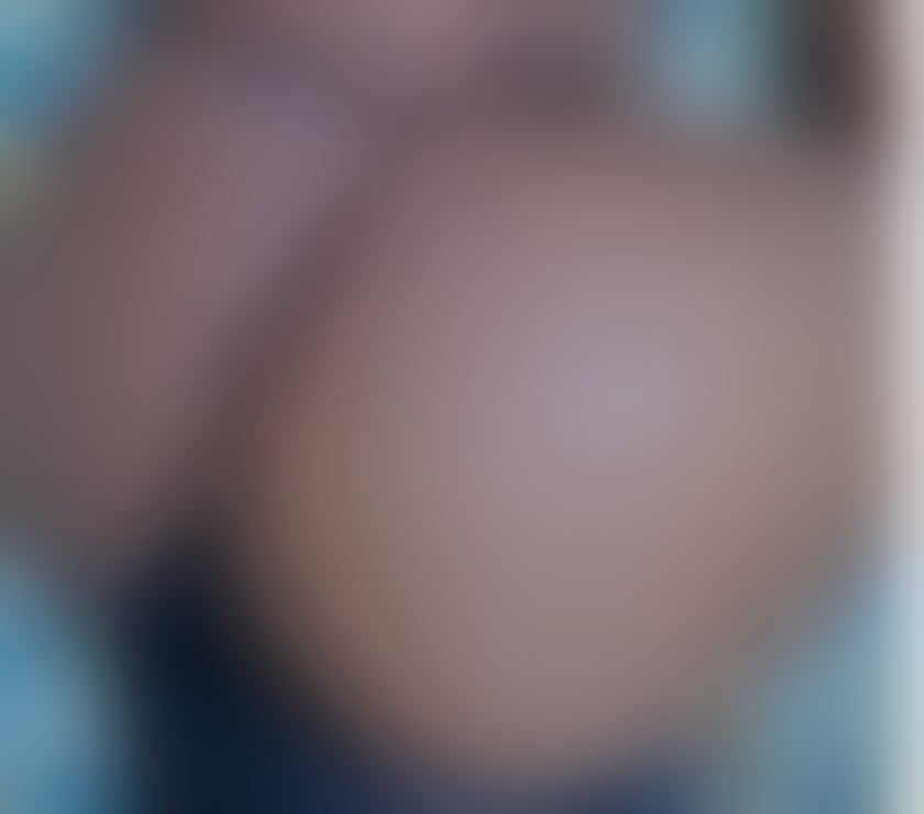 Escorts Kent Medway - Kent - Photos for 💕EBONY NICKI ONLY HERE FOR TODAY BOOK NOW 💕