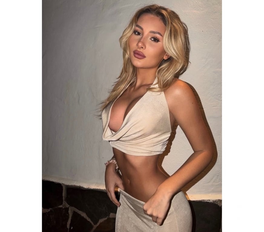 Escorts West Midlands Birmingham - Photos for 🇧🇷 MEL FIRTS TIME IN THE CITY 🔥🕶️🆕