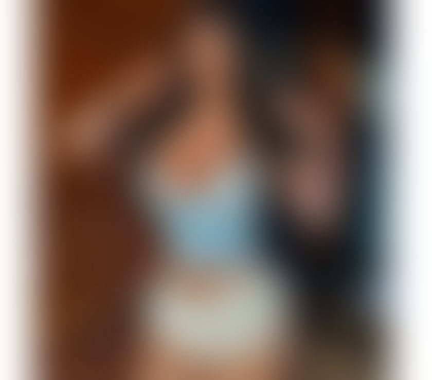 Escorts Dundee Dundee City Centre - Dundee - Photos for 🍓🍒VALESCA BRAZILIAN 💯 % REAL!!