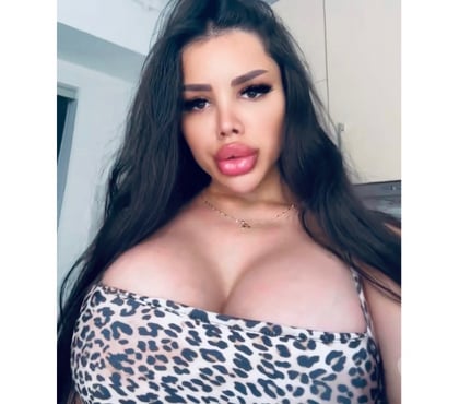 Escorts Chester Cheshire West and Chester - Photos for Shanon 24h in&out p@rt¥