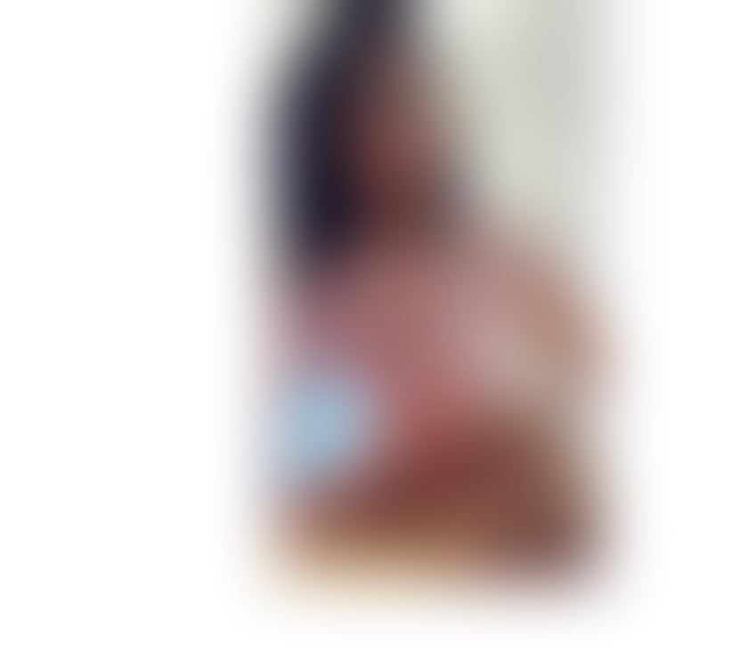 Trans Escorts East London Clapton - East London - Photos for 🍒 SWEET AND HOT 🍒 BEST BJ 🍌🥂 Party