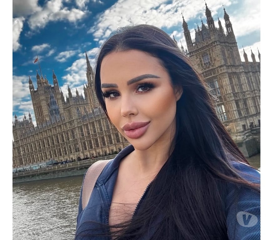 Escorts Bedfordshire Luton - Photos for BRUNA, 🔥BEST BRAZILIAN TOWN 100% REAL