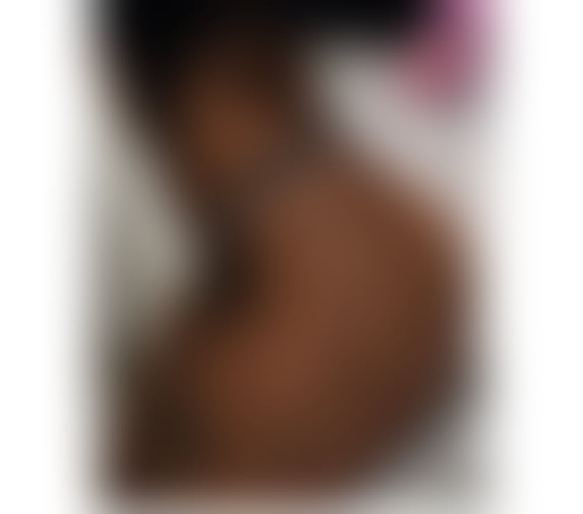 Escorts South East London Peckham - South East London - Photos for ✨NEW IN TOWN💫JUICY BODY🍯BEST CHOICE