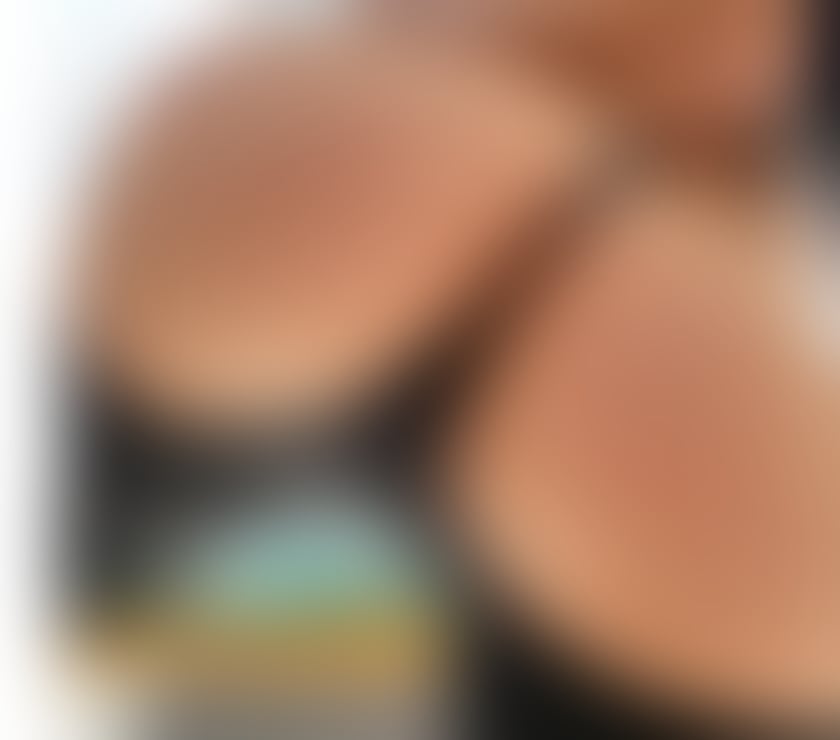 Escorts Glasgow Cumbernauld - Glasgow - Photos for ❤️‍🔥NEW GIRL💝ONLY OUTCALL 💖