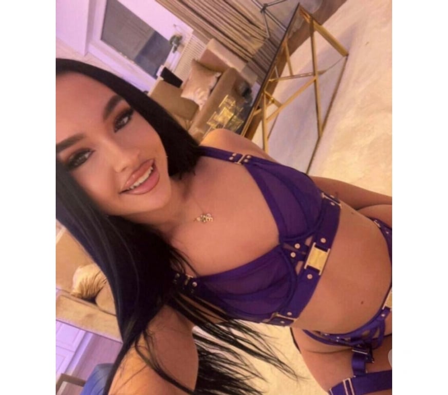 Escorts Fife Glenrothes - Fife - Photos for 🎉 PARTY NATALLY 🎉 STUNNING❤️INCALL&OUTCALL💋