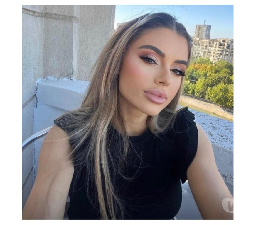 Escorts West Midlands Birmingham - Photos for 💎AVAILABE 24 7 IN YOUR CITY NOW 💎