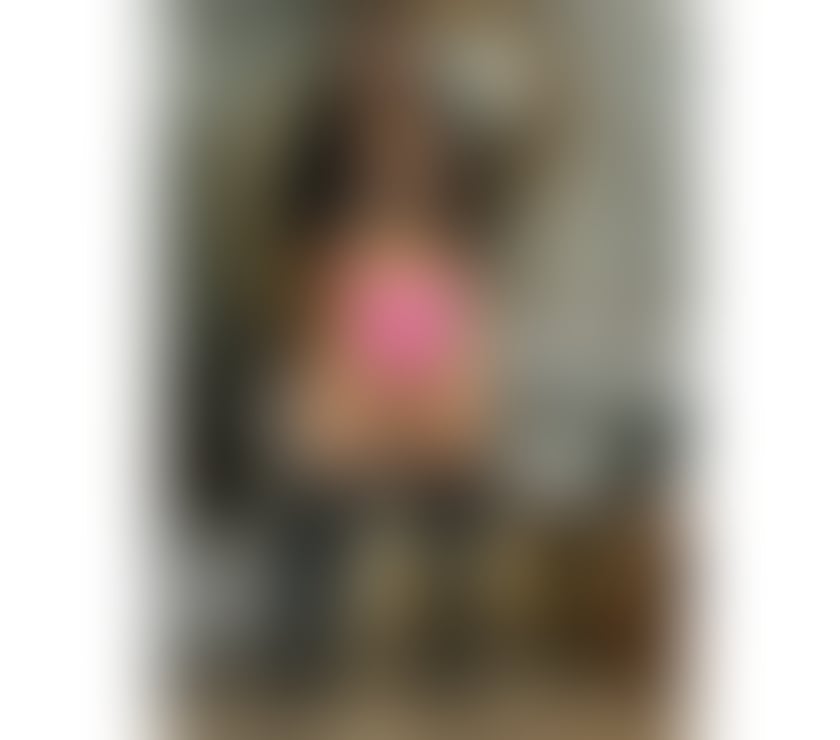 Escorts Edinburgh Edinburgh - Edinburgh - Photos for BEIJOS LENTOS 🇧🇷