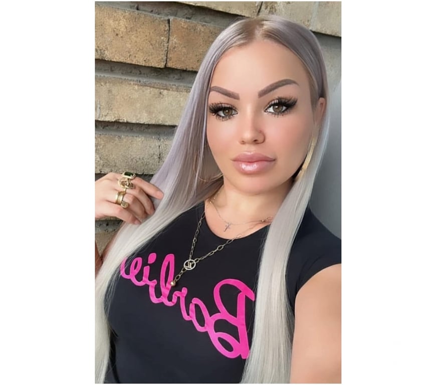 Escorts West Midlands Birmingham - Photos for SWEET GIRL💢Amyra💦PARTY🤯 🎉 outcall