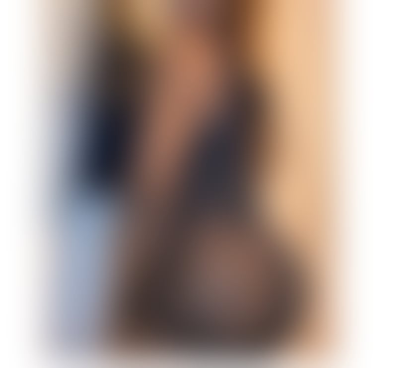 Escorts Kent Medway - Kent - Photos for 🥰🥰BLACK DOLL😘😘Satisfy your cravings😍😍