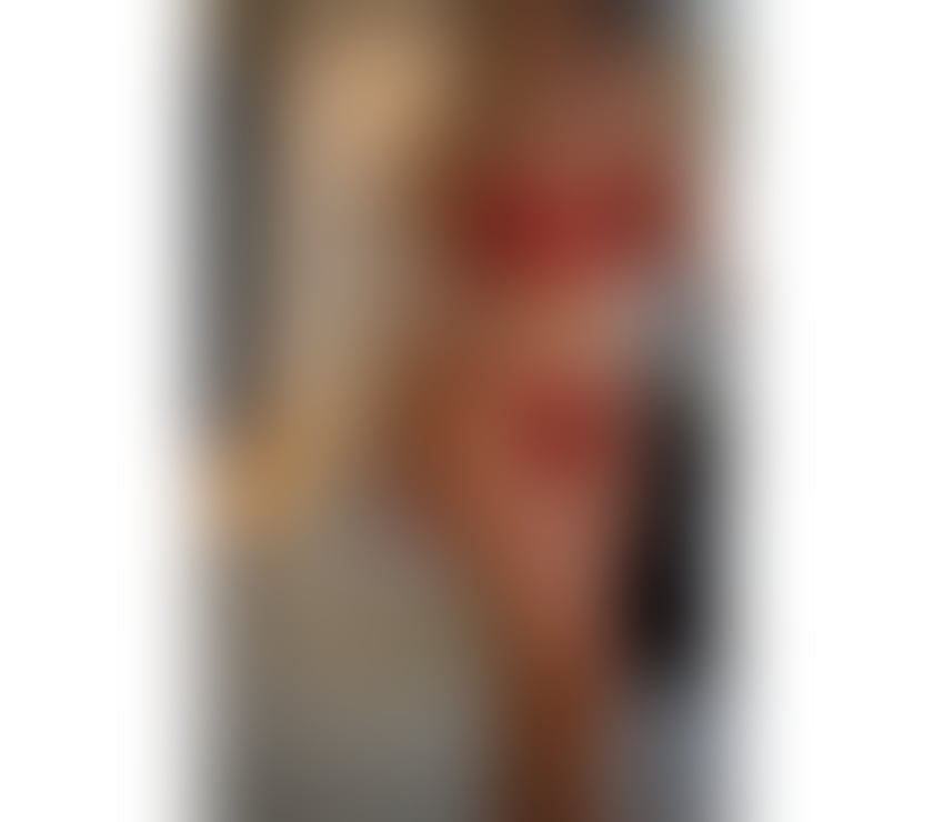 Escorts South East London Denmark Hill Station - South East London - Photos for 🇧🇷 New in town✨best Escort💕 07424973303