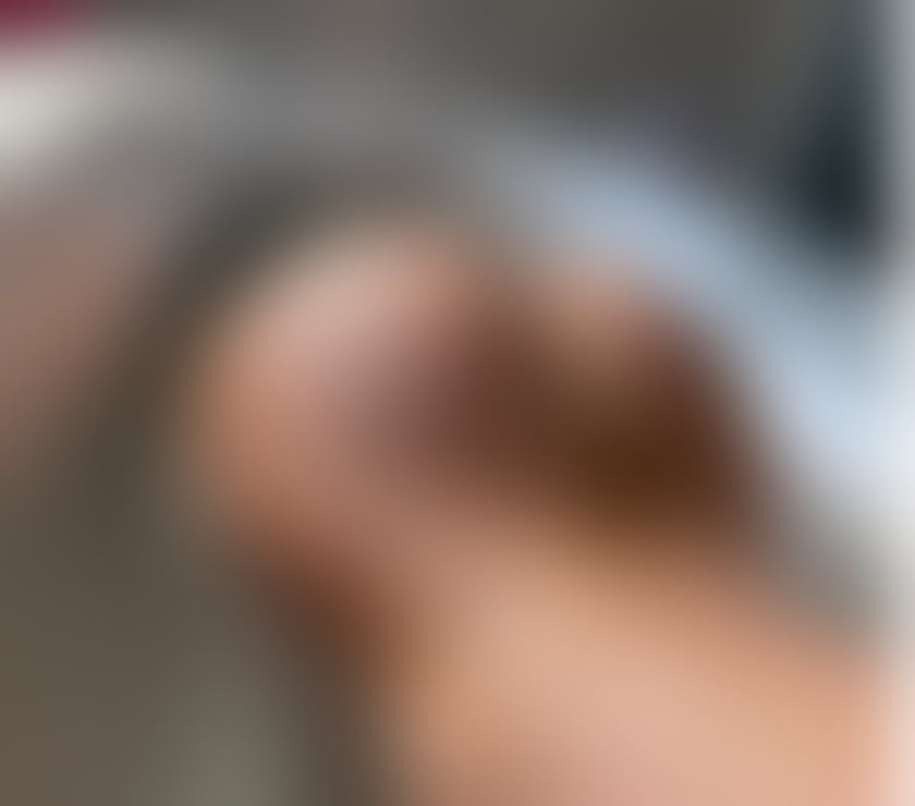 Escorts Bristol Barton Hill - Bristol - Photos for ♥️OUTCALL♥️AVAILABLE NOW♥️BRISTOL