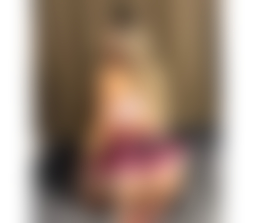 Escorts Surrey Reigate and Banstead - Photos for STUNNINGGIRL❌SEXY&HOT 🍑GENUINE100% PARTY GIRL