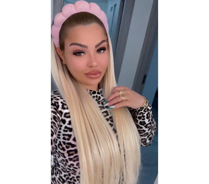 Escorts West Midlands Solihull - Photos for Party💥girl 💥AMYRA💥ONLY OUTCALL💥