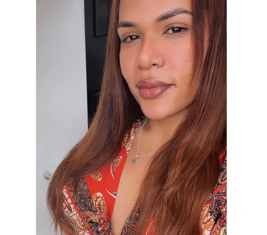 Escorts Essex Southend-on-Sea - Photos for Trans🍆🍑Hot✨ Linna✨ OWO FULL Services