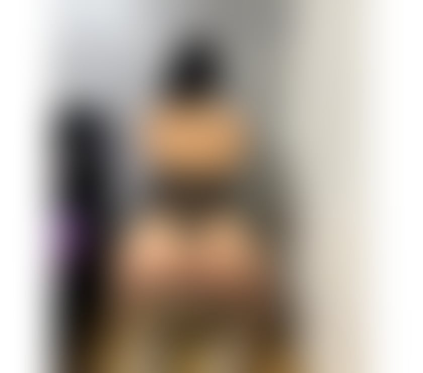 Escorts Fife Kirkcaldy - Fife - Photos for SEXY❌best service❤️pleasure&relax💯NOW GRIL