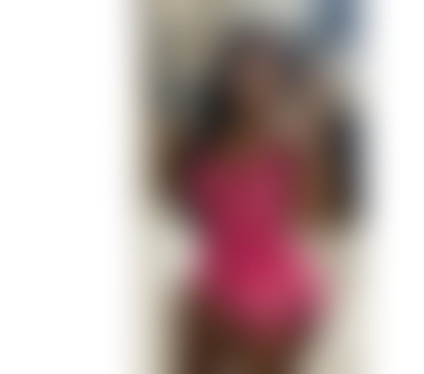 Escorts South East London Sydenham - South East London - Photos for 🔥 HOT PARTY GIRL 🔥DARE TO PLAY‼️‼️🍒🍒