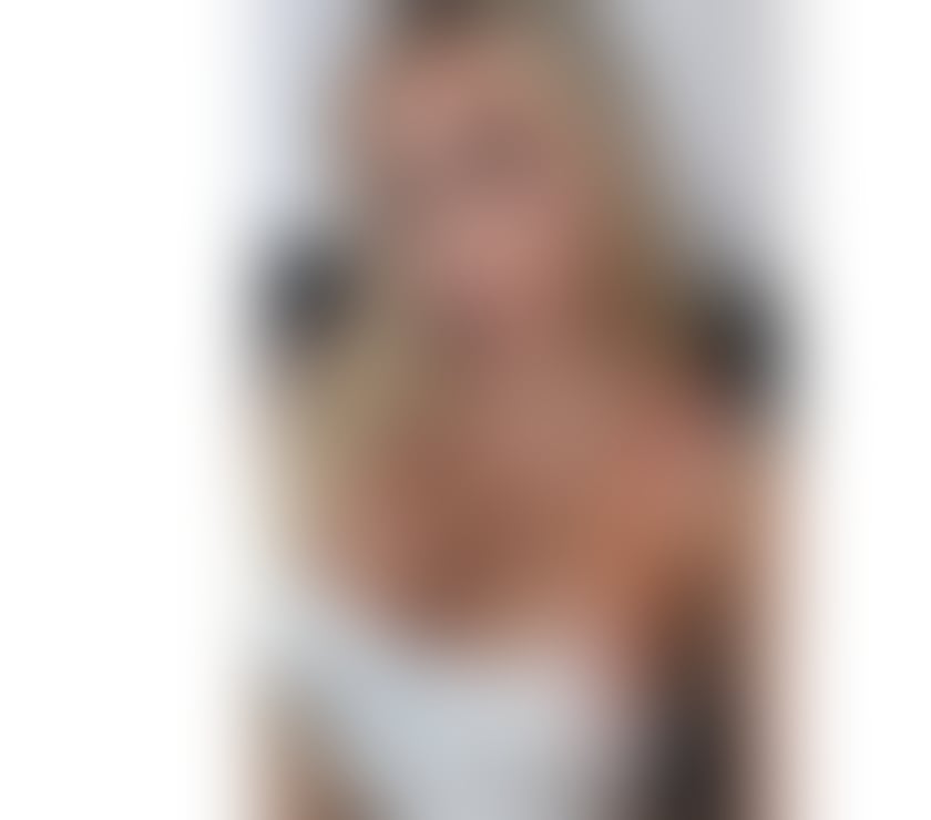 Escorts Blackheath South East London - Photos for 🔴Duda High class‼️Real 💯💥PARTY