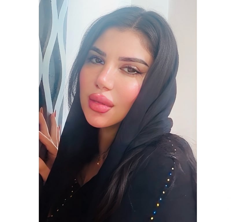 Escorts West Midlands Birmingham - Photos for Malika,Arabian hot Queen WhatsApp 07938172220