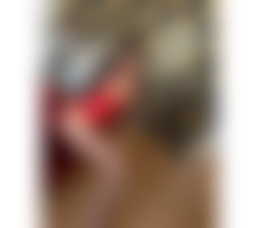 Escorts Derry and Strabane Londonderry - Derry and Strabane - Photos for ANNE🥰NEW IN TOWN🥰REAL PICTURE 100%🥰