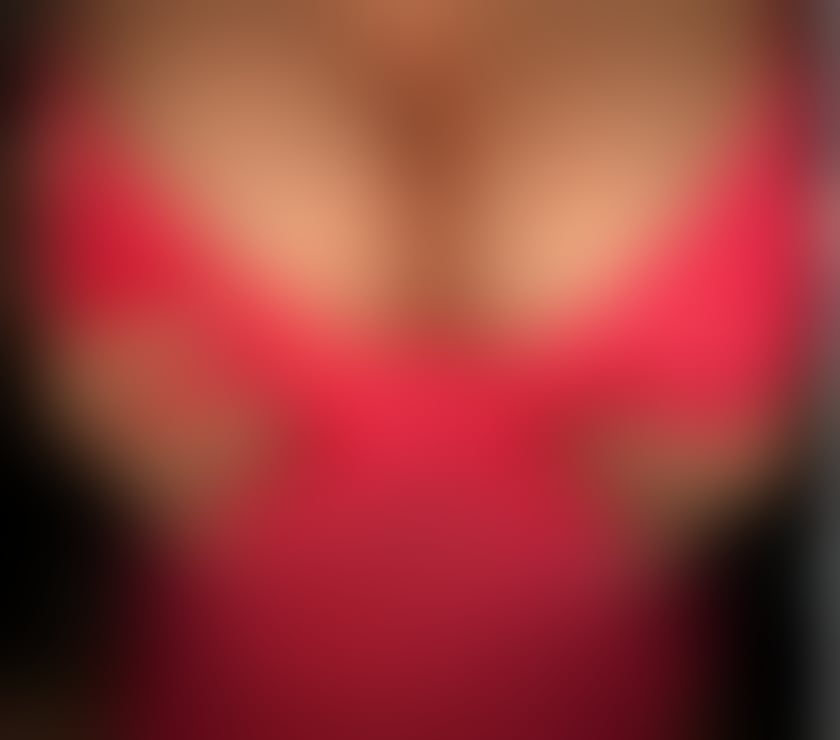 Escorts Kent Medway - Kent - Photos for 💥 Escape into Pleasure B2B Bliss With an massage