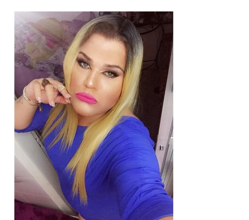 Trans Escorts Merseyside Liverpool - Photos for 🍒 CHERRY 🍒 TS PARTY 🥳 Avaliable Liverpool