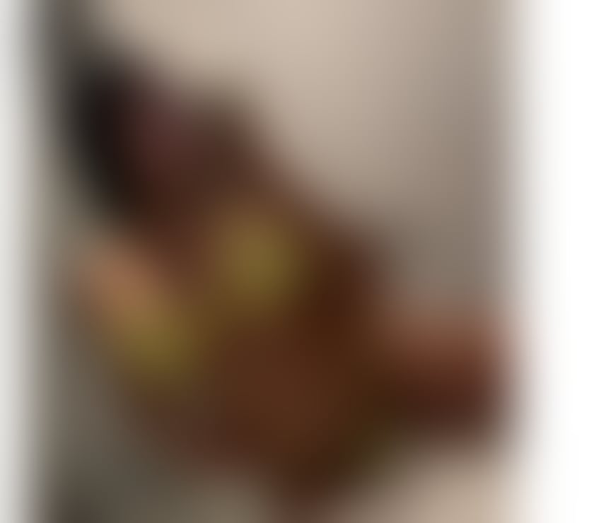 Escorts Norfolk Norwich - Photos for 💯REAL GIRL JESSICA💯ONLY OUTCAL