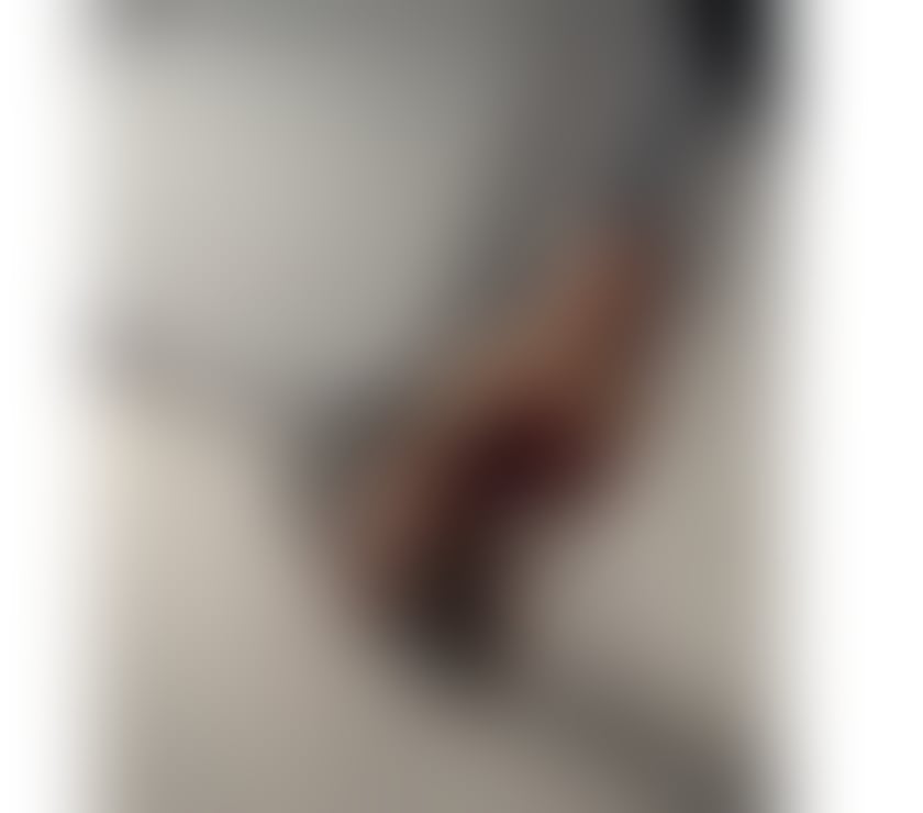 Escorts Morley Leeds - Photos for ✨ Erika Party Girl ✨