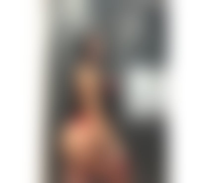 Escorts West Midlands Birmingham - Photos for 🌟SOFIE🌟 FRENCH KISS 🌟FREE 100%REAL‼️