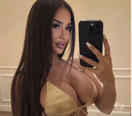 Outcall Escorts Allington Maidstone - Photos for ✅Annabelle — Outcall Ready | Party Vibes✅