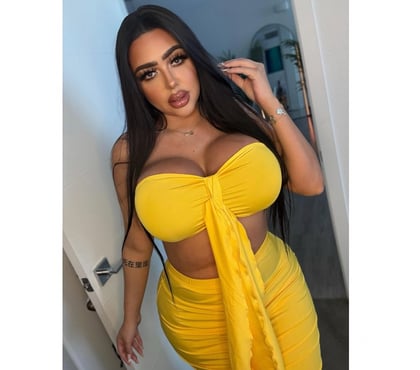 Escorts Acocks Green Birmingham - Photos for 🩷HOTTEST🌸BABE🌸TOP🩷YOUNG🌸NO-RUSH🌴