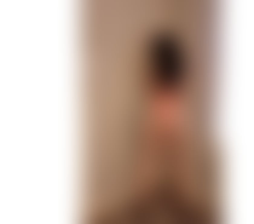 Escorts South East London Grove Park - South East London - Photos for 🌹Mellysa🌹The best services 💦New in Town 🔥