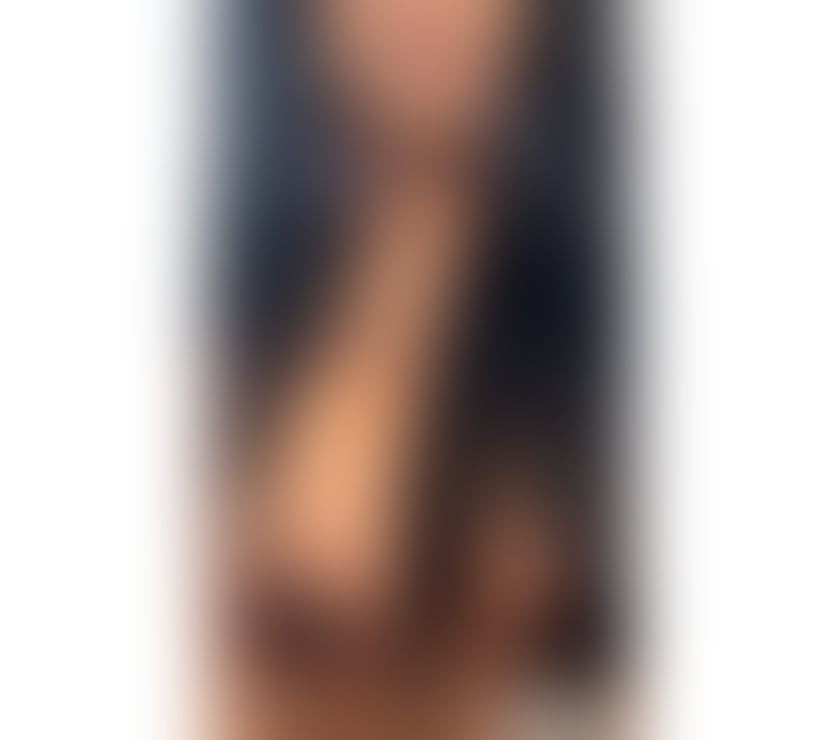 Escorts Glasgow Mount Vernon - Glasgow - Photos for 🔴🔴BLACK BEAUTY🔴🔴INCALL - OUTCALL