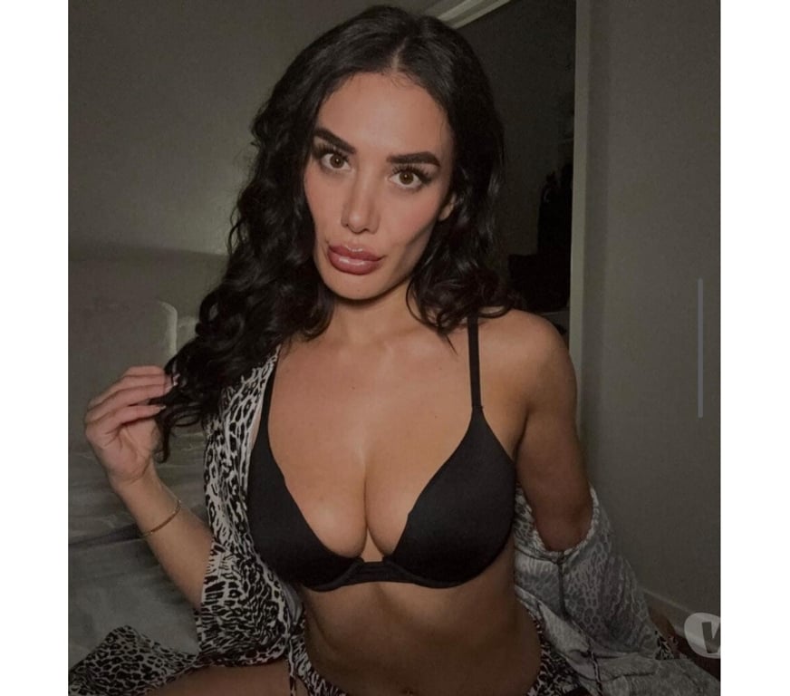 Escorts Lancashire Burnley - Photos for 💥ANA 🇧🇷 NAUGHTY SENSUAL AND ADDICTIVE🔞